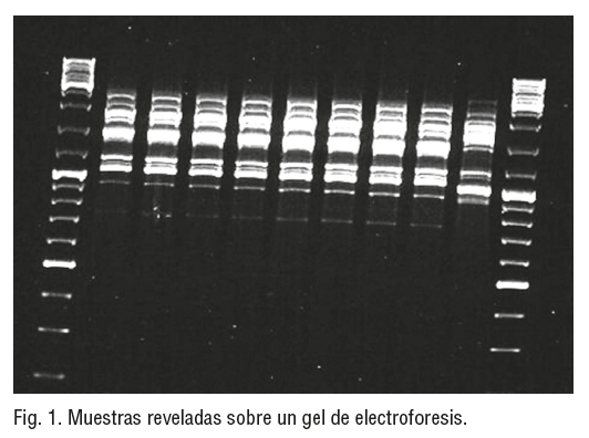 Fig. 1. Muestras reveladas sobre un gel de electroforesis
